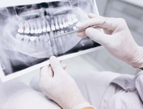 Las radiografías dentales no están contraindicadas en el embarazo